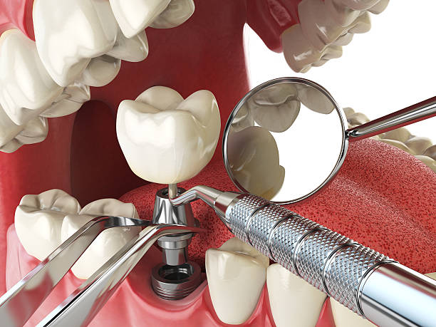 Best Emergency Treatment for Dental Infections or Abscesses in Comanche, OK